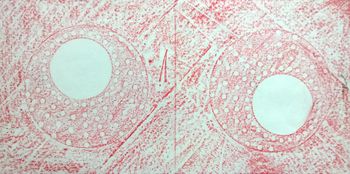 10.11.2016 Verschiedene Oberflächen - various surfaces - surfaces différentes - różne powierzchnie Matthias Harnisch - Frottage du jour
