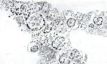 18.04.2025 Flechte - lichen - lichen - porost Matthias Harnisch * Frottage du jour