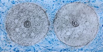 25.11.2020 Verschiedene Oberflächen - various surfaces - surfaces différentes - różne powierzchnie Matthias Harnisch * Frottage du jour
