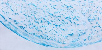 21.02.2021   Eis/Kunststoff - ice/synthetic material - glace/matière plastique - lód/tworzywo Matthias Harnisch * Frottage du jour